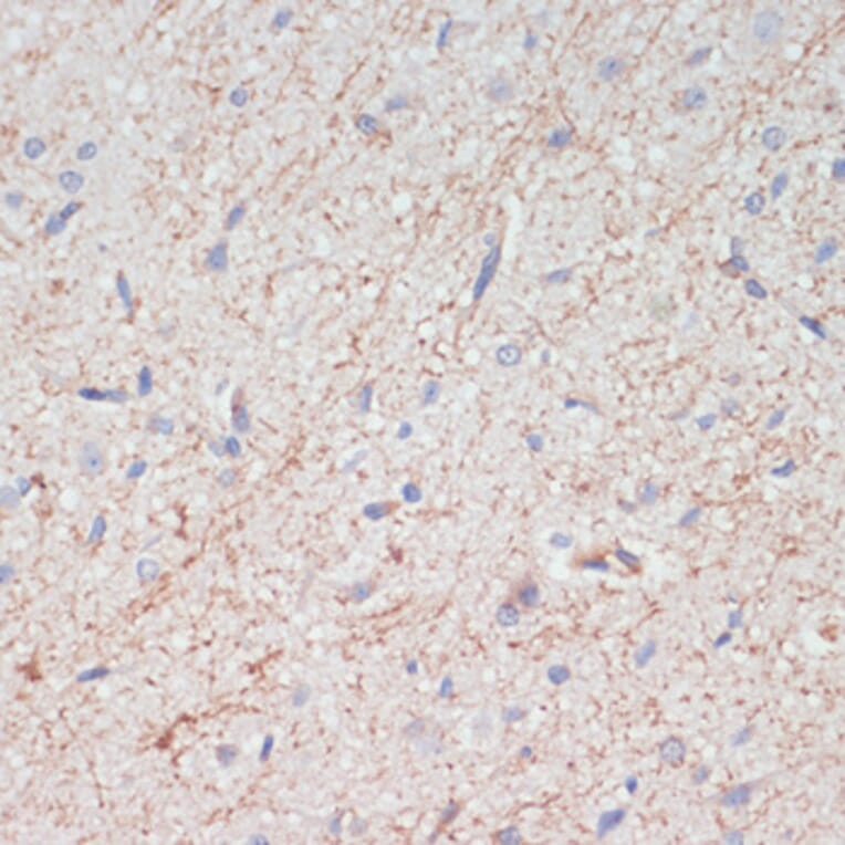 Immunohistochemistry - Anti-Dopamine Transporter Antibody (A91403) - Antibodies.com