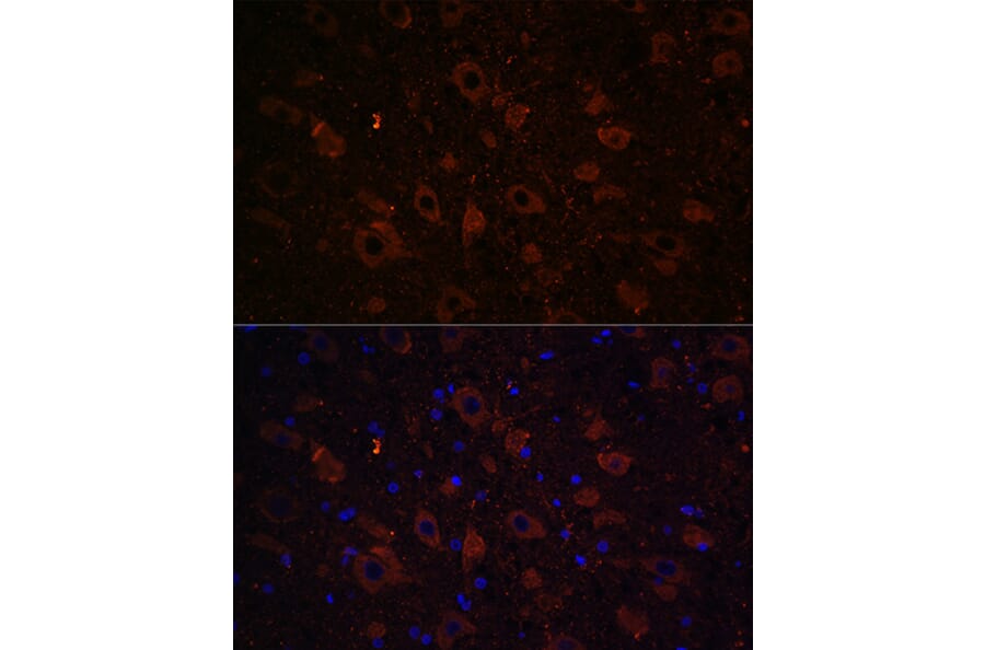 Immunofluorescence - Anti-Dopamine Transporter Antibody (A91403) - Antibodies.com