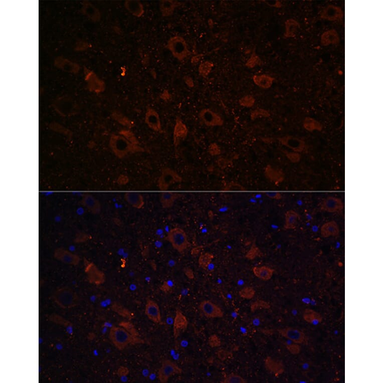 Immunofluorescence - Anti-Dopamine Transporter Antibody (A91403) - Antibodies.com