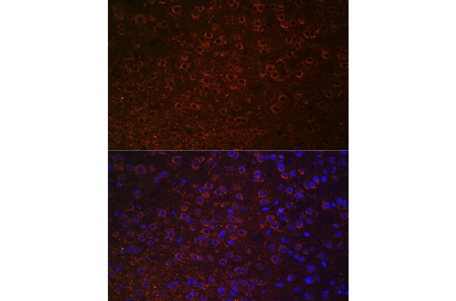 Immunofluorescence - Anti-Dopamine Transporter Antibody (A91403) - Antibodies.com
