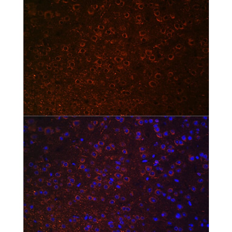 Immunofluorescence - Anti-Dopamine Transporter Antibody (A91403) - Antibodies.com