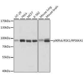 Western Blot - Anti-RSK1 p90 Antibody (A91404) - Antibodies.com