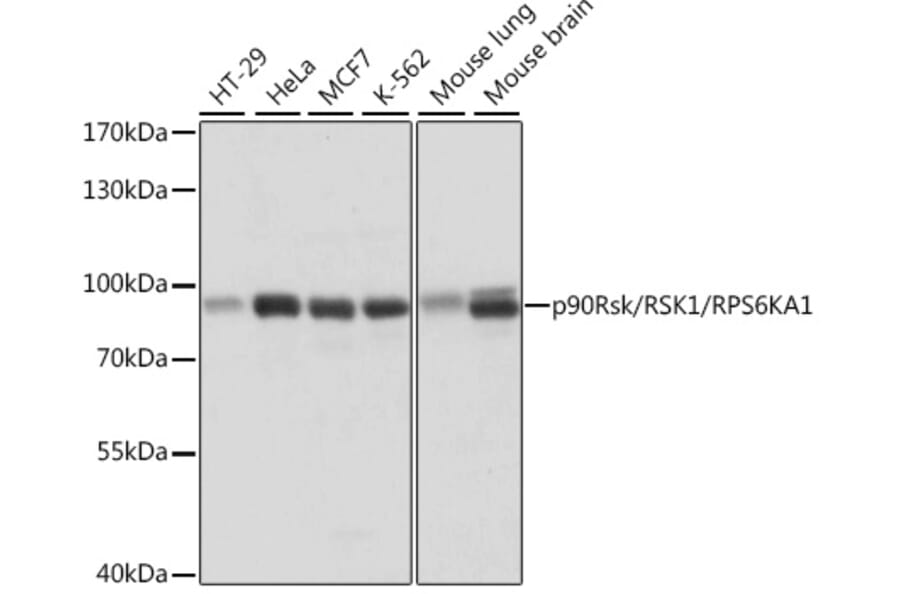 Western Blot - Anti-RSK1 p90 Antibody (A91404) - Antibodies.com