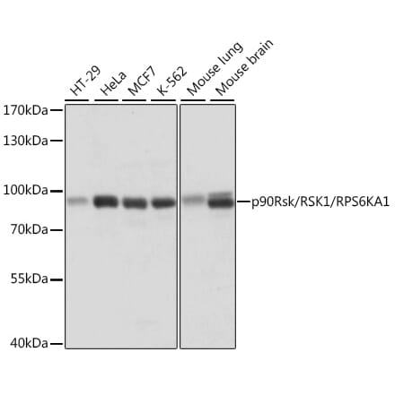 Western Blot - Anti-RSK1 p90 Antibody (A91404) - Antibodies.com