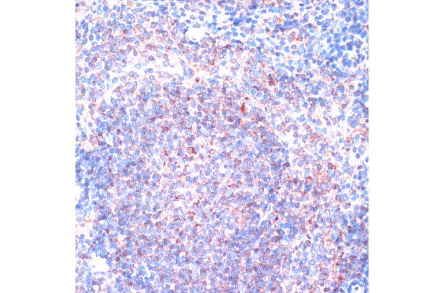 Immunohistochemistry - Anti-RSK1 p90 Antibody (A91404) - Antibodies.com