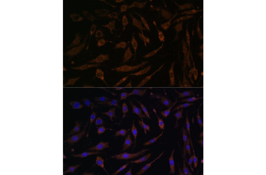Immunofluorescence - Anti-RSK1 p90 Antibody (A91404) - Antibodies.com
