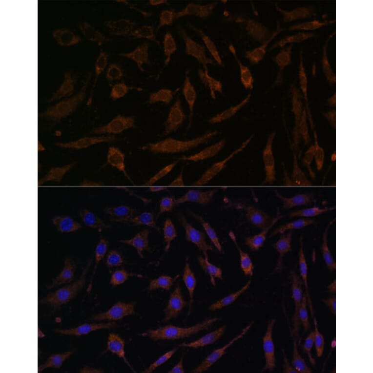 Immunofluorescence - Anti-RSK1 p90 Antibody (A91404) - Antibodies.com