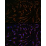 Immunofluorescence - Anti-RSK1 p90 Antibody (A91404) - Antibodies.com