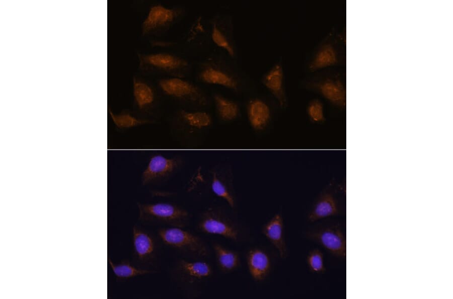 Immunofluorescence - Anti-RSK1 p90 Antibody (A91404) - Antibodies.com