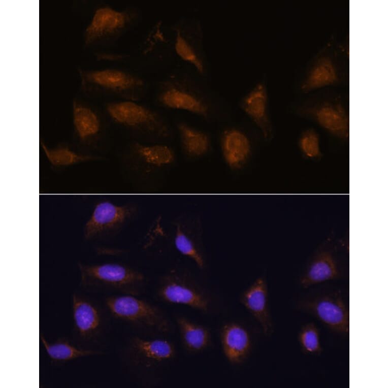Immunofluorescence - Anti-RSK1 p90 Antibody (A91404) - Antibodies.com