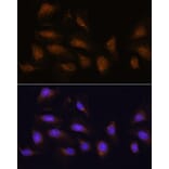 Immunofluorescence - Anti-RSK1 p90 Antibody (A91404) - Antibodies.com