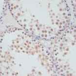 Immunohistochemistry - Anti-MSK1 (phospho Ser376) Antibody (A91406) - Antibodies.com