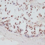 Immunohistochemistry - Anti-MSK1 (phospho Ser376) Antibody (A91406) - Antibodies.com