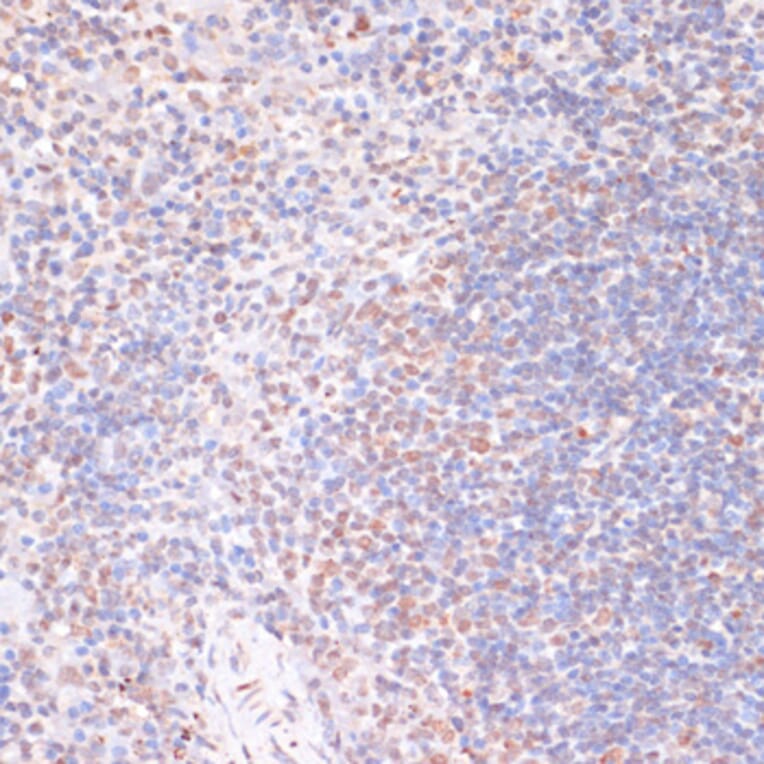 Immunohistochemistry - Anti-MSK1 (phospho Ser376) Antibody (A91406) - Antibodies.com