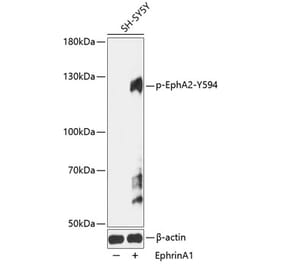 Western Blot - Anti-Eph receptor A2 (phospho Tyr594) Antibody (A91407) - Antibodies.com