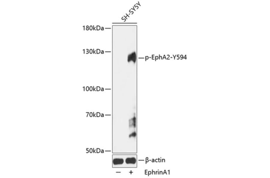 Western Blot - Anti-Eph receptor A2 (phospho Tyr594) Antibody (A91407) - Antibodies.com