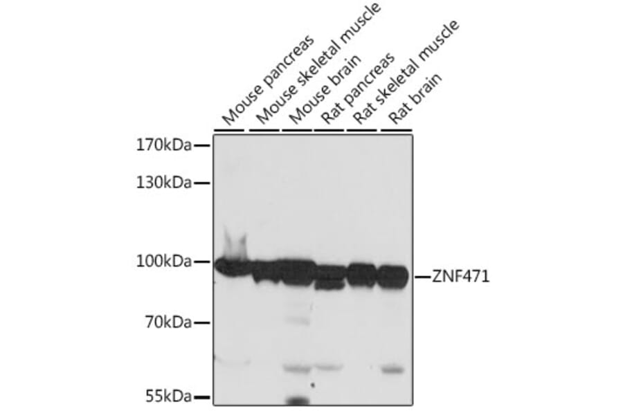 Western Blot - Anti-ZNF471/ERP1 Antibody (A91408) - Antibodies.com