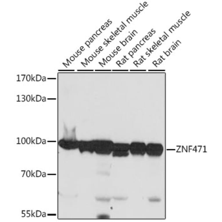 Western Blot - Anti-ZNF471/ERP1 Antibody (A91408) - Antibodies.com