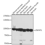 Western Blot - Anti-ZNF471/ERP1 Antibody (A91408) - Antibodies.com