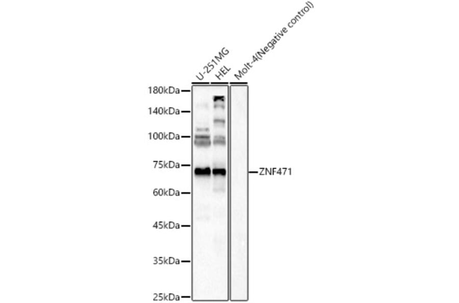 Western Blot - Anti-ZNF471/ERP1 Antibody (A91409) - Antibodies.com