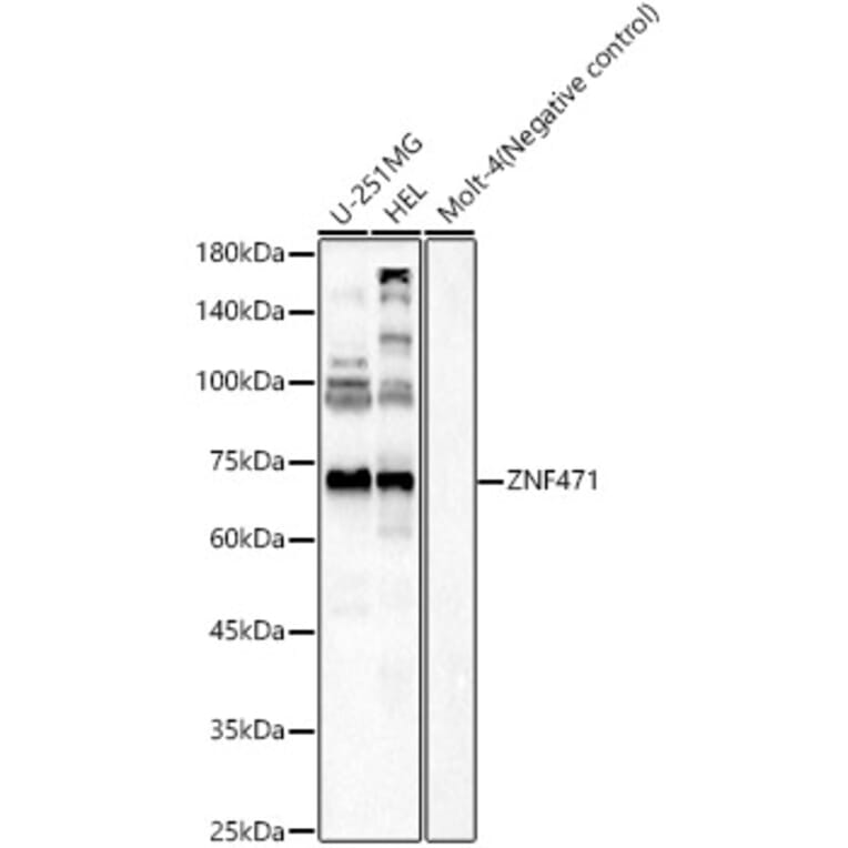 Western Blot - Anti-ZNF471/ERP1 Antibody (A91409) - Antibodies.com