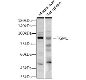 Western Blot - Anti-TGM1 Antibody (A91410) - Antibodies.com