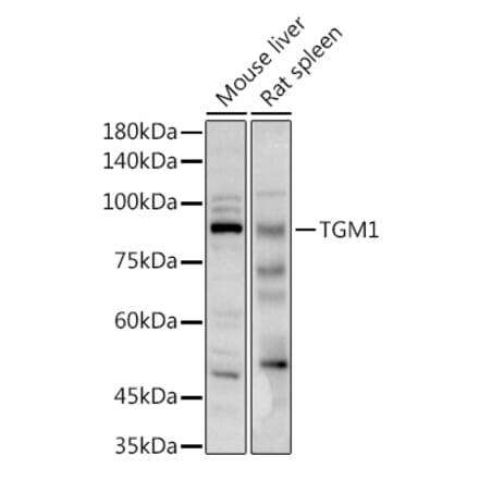 Western Blot - Anti-TGM1 Antibody (A91410) - Antibodies.com