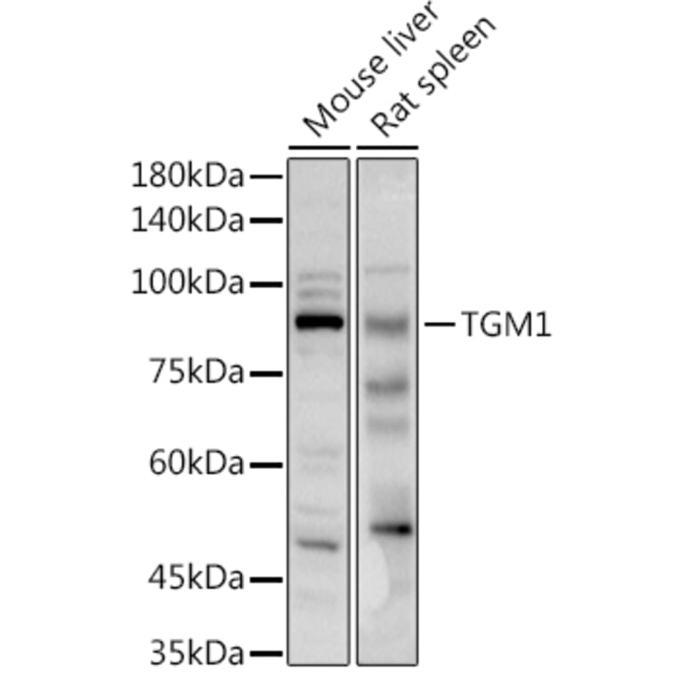 Western Blot - Anti-TGM1 Antibody (A91410) - Antibodies.com