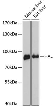 Western blot analysis of extracts of various cell lines, using Anti-HAL Antibody (A13021) at 1:3000 dilution.
Secondary antibody: Goat Anti-Rabbit IgG (H+L) (HRP) (AS014) at 1:10,000 dilution.
Lysates / proteins: 25µg per lane.
Blocking buffer: 3% non-fat dry milk in TBST.
Detection: ECL Enhanced Kit (RM00021).
Exposure time: 90s.