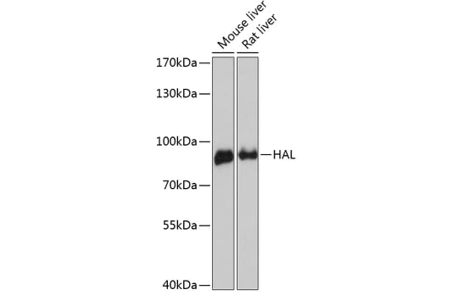 Western Blot - Anti-Histidase Antibody (A91411) - Antibodies.com