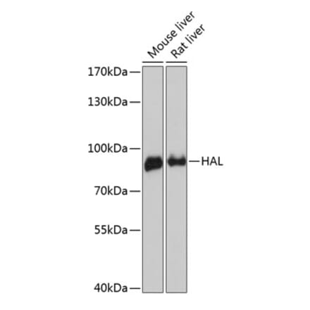 Western Blot - Anti-Histidase Antibody (A91411) - Antibodies.com