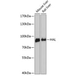 Western Blot - Anti-Histidase Antibody (A91411) - Antibodies.com