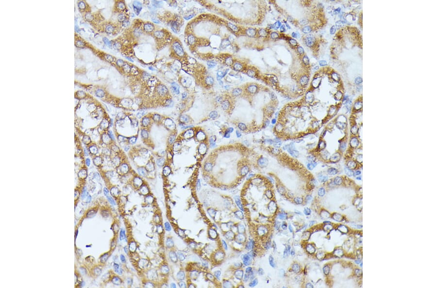Immunohistochemistry - Anti-Histidase Antibody (A91411) - Antibodies.com