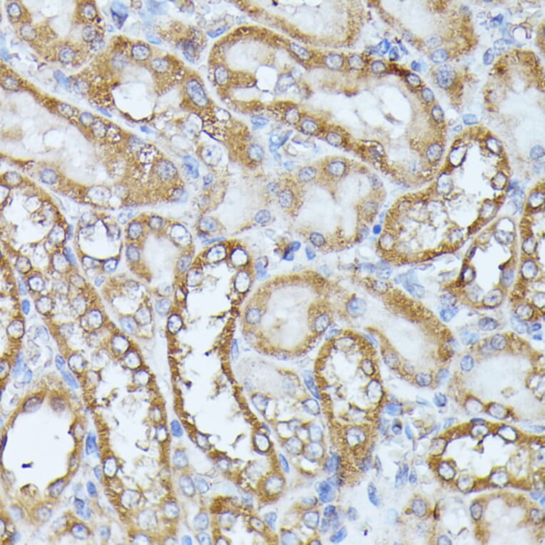 Immunohistochemistry - Anti-Histidase Antibody (A91411) - Antibodies.com