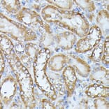 Immunohistochemistry - Anti-Histidase Antibody (A91411) - Antibodies.com