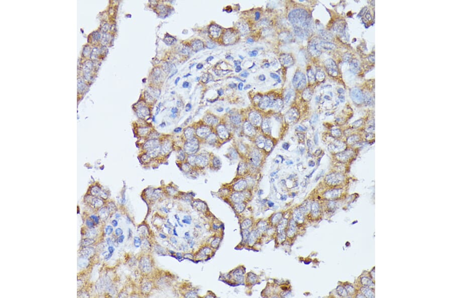 Immunohistochemistry - Anti-Histidase Antibody (A91411) - Antibodies.com
