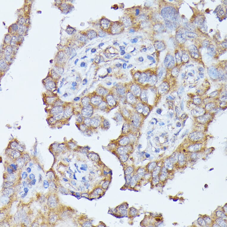 Immunohistochemistry - Anti-Histidase Antibody (A91411) - Antibodies.com