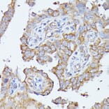 Immunohistochemistry - Anti-Histidase Antibody (A91411) - Antibodies.com