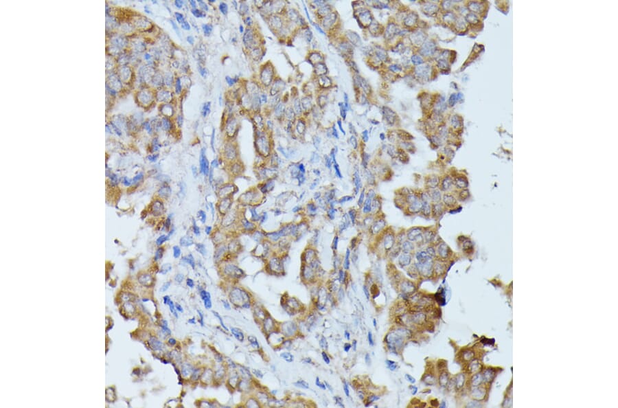 Immunohistochemistry - Anti-Histidase Antibody (A91411) - Antibodies.com