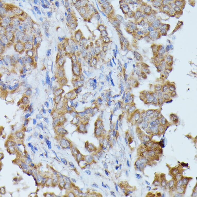 Immunohistochemistry - Anti-Histidase Antibody (A91411) - Antibodies.com