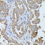 Immunohistochemistry - Anti-Histidase Antibody (A91411) - Antibodies.com