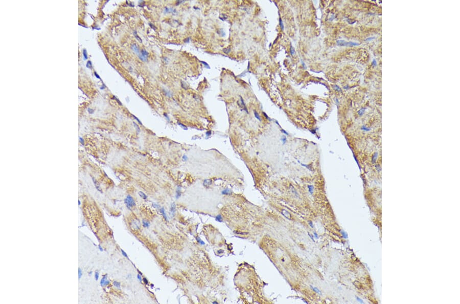 Immunohistochemistry - Anti-Histidase Antibody (A91411) - Antibodies.com