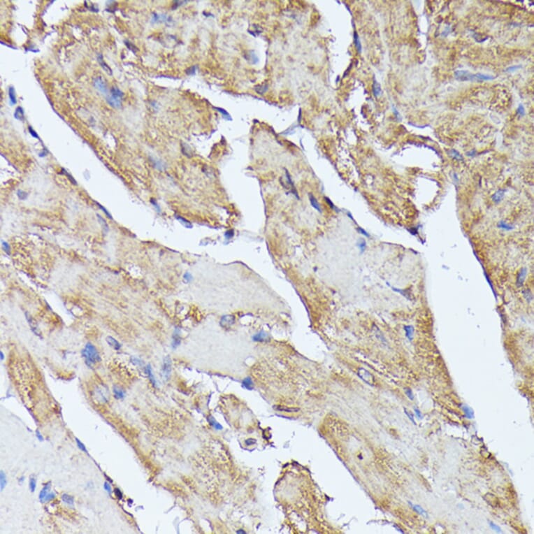 Immunohistochemistry - Anti-Histidase Antibody (A91411) - Antibodies.com