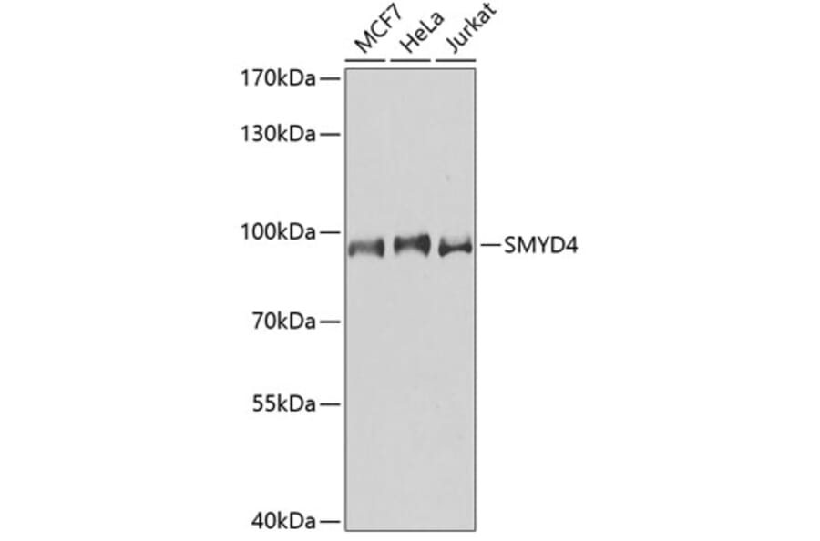 Western Blot - Anti-SMYD4 Antibody (A91412) - Antibodies.com