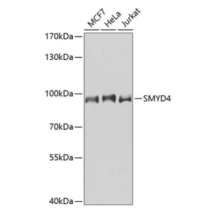 Western Blot - Anti-SMYD4 Antibody (A91412) - Antibodies.com