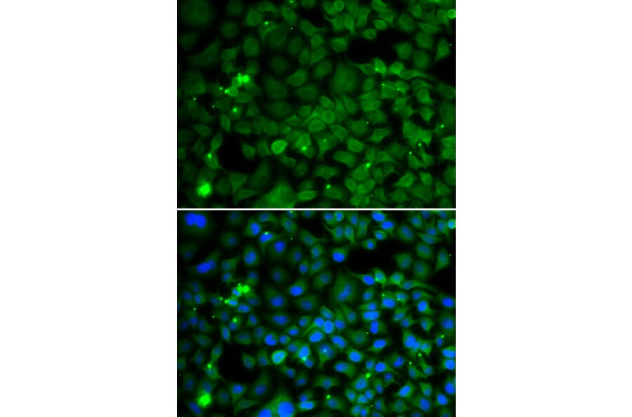 Immunofluorescence - Anti-SMYD4 Antibody (A91412) - Antibodies.com