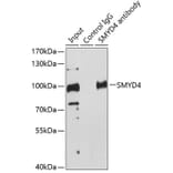 Western Blot - Anti-SMYD4 Antibody (A91412) - Antibodies.com