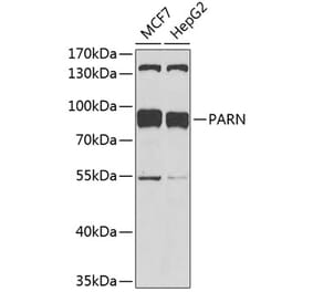 Western Blot - Anti-PARN Antibody (A91413) - Antibodies.com