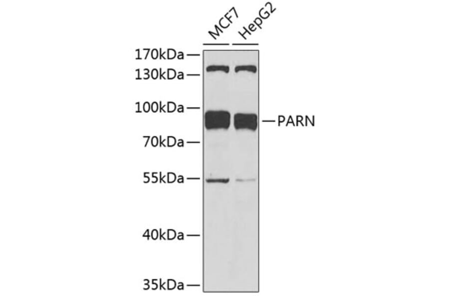 Western Blot - Anti-PARN Antibody (A91413) - Antibodies.com