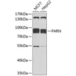 Western Blot - Anti-PARN Antibody (A91413) - Antibodies.com